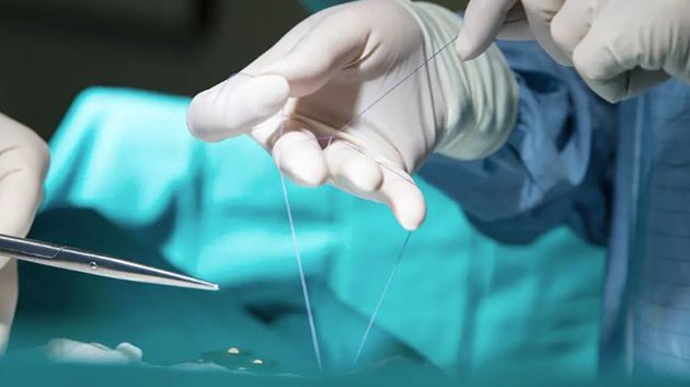 فرنسا: نجاح عملية جراحية بدماغ جنين داخل رحم أمه