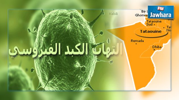 تطاوين : إصابة 7 تلاميذ بالتهاب الكبد الفيروسي صنف