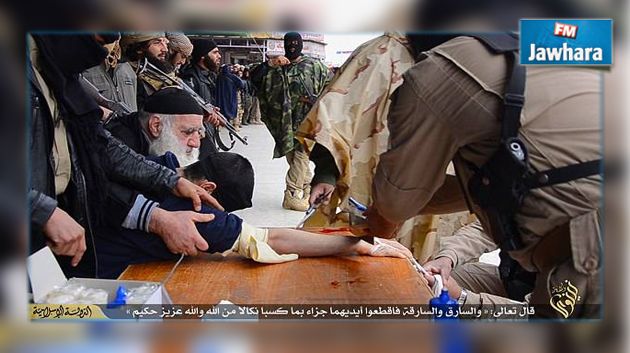 داعش يقطع يد شاب بساطور
