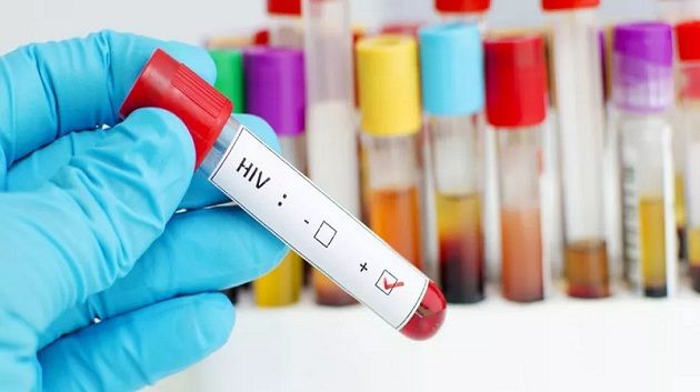 حوالي 7800 شخص متعايشين مع فيروس 'السيدا' في تونس