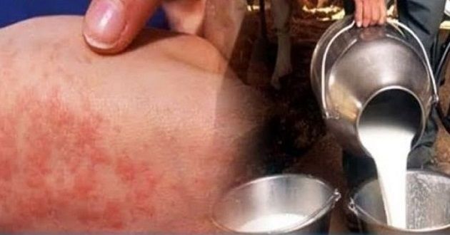 عميد الأطباء البياطرة يحذّر من وضعية كارثيّة بسبب كل من الحمى القلاعية والمالطية وداء الكلب