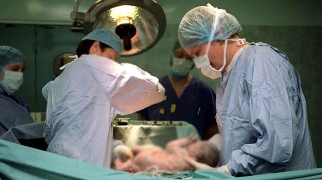 44.4 % من الولادات في تونس  قيصرية 