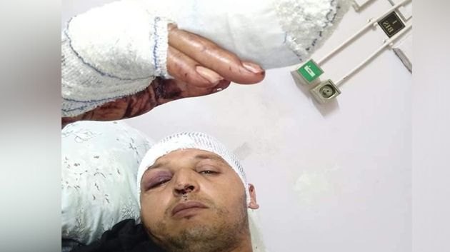 سوسة: 'براكاج' لسائق تاكسي يتسبّب في بتر جزء من أصابعه