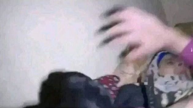 مُسّنة فلسطينية تروي تفاصيل تعرضها لهجوم كلب بوليسي (فيديو)