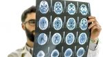 دراسة تكشف عن منطقة في الدماغ مسؤولة عن 'الفضول لدى البشر'