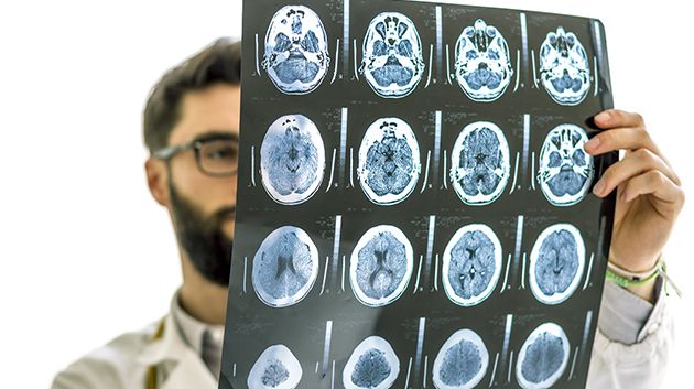 دراسة تكشف عن منطقة في الدماغ مسؤولة عن 'الفضول لدى البشر'