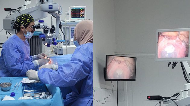 نجاح أوّل عملية زراعة قرنية في المستشفى الجامعي بقابس