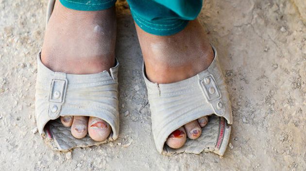 دراسة: حوالي 826 ألف طفل في تونس يعيشون تحت خط الفقر