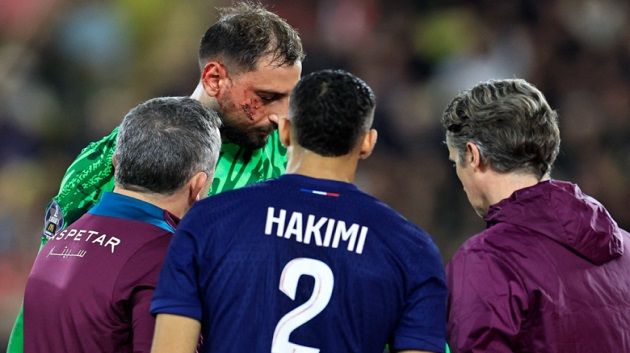 الدوري الفرنسي: إصابة قوية لدوناروما على مستوى الوجه