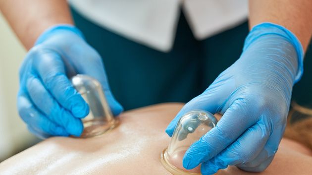 سوسة: الكشف عن مركز عشوائي لممارسة 'الحجامة'