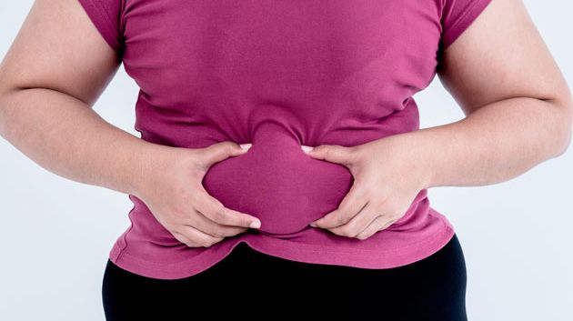 توقعات بارتفاع معدل إنتشار السمنة في تونس