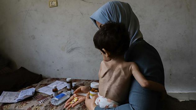 خلال يوم واحد.. وفاة 8 أشخاص بينهم طفل نتيجة المجاعة في القطاع