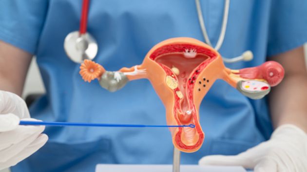 نسبة إجراء اختبار الكشف عن سرطان عنق الرحم في تونس لا تتجاوز 14 إلى 16 %