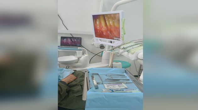 قفصة: نجاح أول عملية زرع لثة 