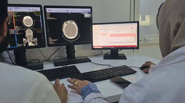 إنجاز طبي: منصّة NAJDA AVC  تساهم في إنقاذ أوّل مريض جلطة دماغية بمدنين  