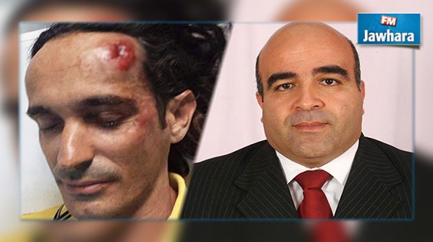 إعفاء معتمد الحمامات من مهامه بعد اعتدائه على أجنبي مقيم بتونس