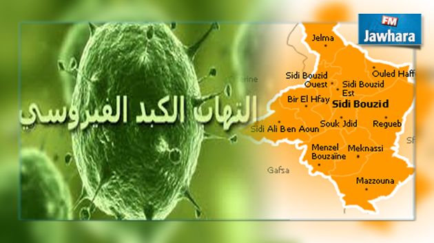 سيدي بوزيد : وفاة طفلة بمرض الالتهاب الكبدي