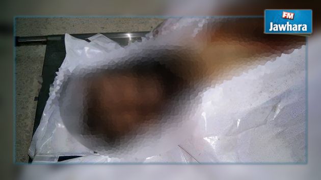 حالة طوارئ في مستشفى القصرين بعد تسريب صور لجثة الارهابي