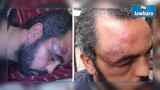 الأمن يعتدي على عصام السلامي