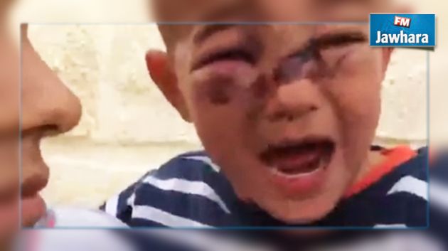 تعرض طفل للاعتداء من أمنيين في
