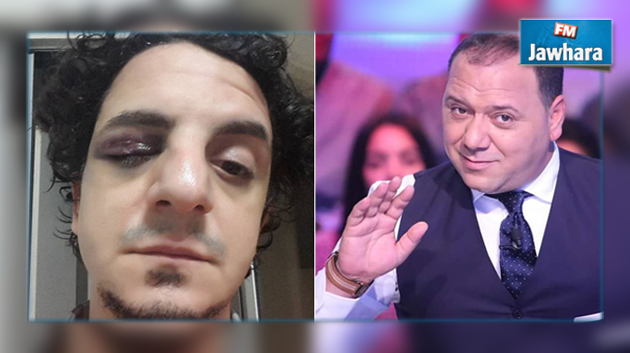 وليد التونسي يعتدي بالعنف على عاطف نور