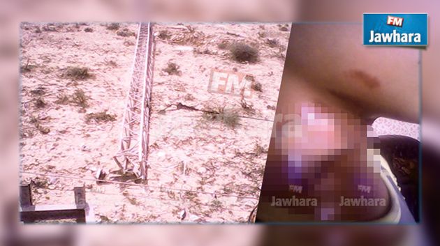 عمود كهربائي يتسبب في إصابة طفل بأولاد الشامخ : معتمد الجهة يوضّح