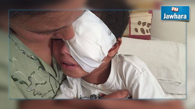 فقأت معلمته عينه : الطفل هيثم يواجه مصيرا صعبا بجسده النحيل بعد أن فقد بصره