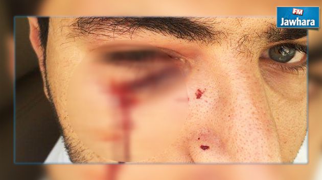 فشل في امتحان السياقة فشوه وجه المدرس