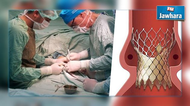قضية اللوالب : الأطباء والصيادلة يطالبون بتحقيق شفاف وعادل