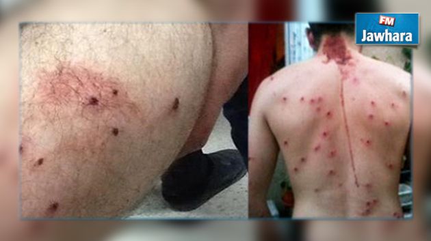 الرقاب : إصابة 14 شخصا بالرش خلال حفل زفاف