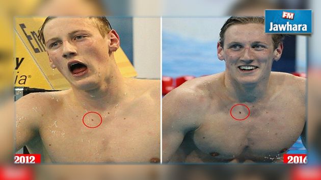 معجب ينقذ بطلا أولمبيا في السباحة من الإصابة بسرطان الجلد 