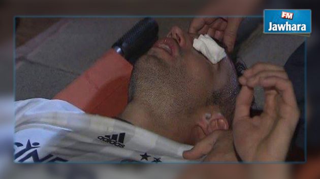 فان بيرسي قد يفقد بصره بعد إصابة خطيرة في العين