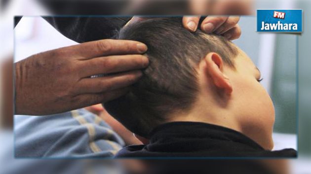 بنزرت : تسجيل 33 حالة إصابة بالقمل بمدرسة ابتدائية