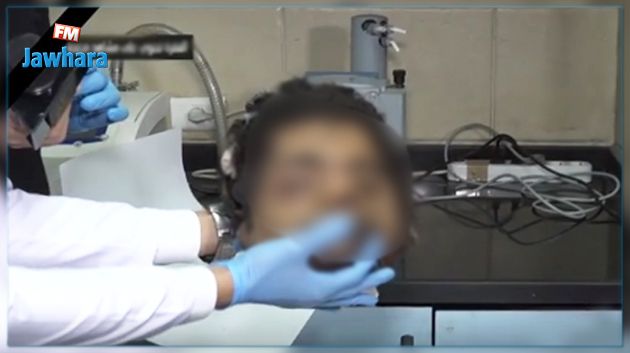 قناة مصرية تعرض فيديو لرأس منفذ عملية الكاتدرائية !