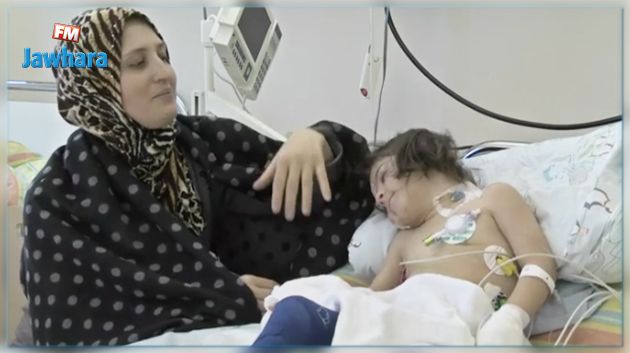 طبيبة ألمانية تعيد الأمل لطفلة سورية احترقت في الحرب