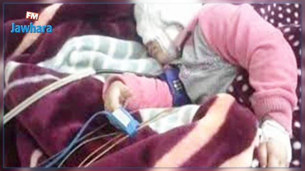 زغوان : إصابة طفلة على اثر انفجار خرطوشة