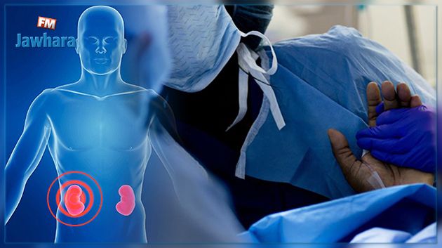 زرع الكلى في تونس : 1400 مريض على قائمة الانتظار