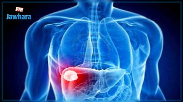 توصيات وزارة الصحّة للوقاية من مرض الكبد الفيروسي