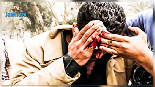 خارج أوقات عمله : تعرّض عون أمن إلى اعتداء بقارورة