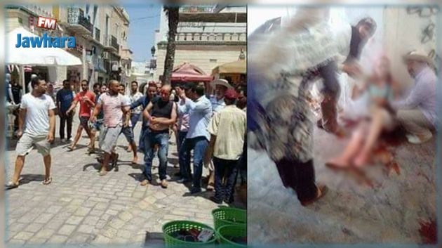 السائحتان الألمانيتان اللتان طعنتا بسكين في حالة مستقرة 