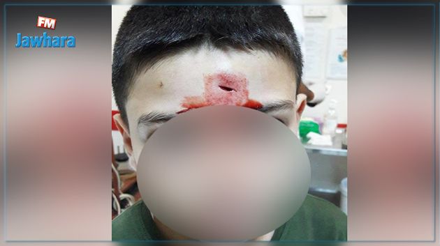 مواطن : ابني أصيب في المدرسة وظل ساعتين ينزف دون اسعافه !