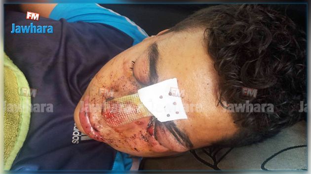 فتح بحث في ملابسات إصابة مواطن أثناء مطاردة أمنية في المكنين