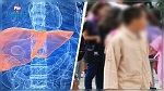 القصرين : إصابة تلميذ بالتهاب الكبد الفيروسي صنف أ 