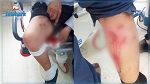 حمام الأنف : قرد هائج يتسبب في إصابة 3 أشخاص بجروح