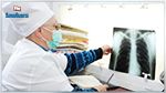 بولونيا :تسجيل أكثر من خمسة آلاف حالة مرض السل