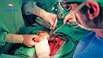 لأول مرة بمستشفى جربة: إجراء عمليتين لجراحة الفتق وتكميم المعدة بالمنظار