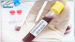 28 إصابة جديدة بفيروس كورونا في تونس