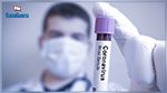 وزارة الصحة : 33 إصابة جديدة بفيروس كورونا