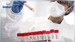 الجزائر : 483 إصابة جديدة بفيروس كورونا