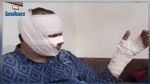 خلال مداهمة أمنية: بائع خمر يضرم النار في منزله ويتسبب لإطار أمني في حروق